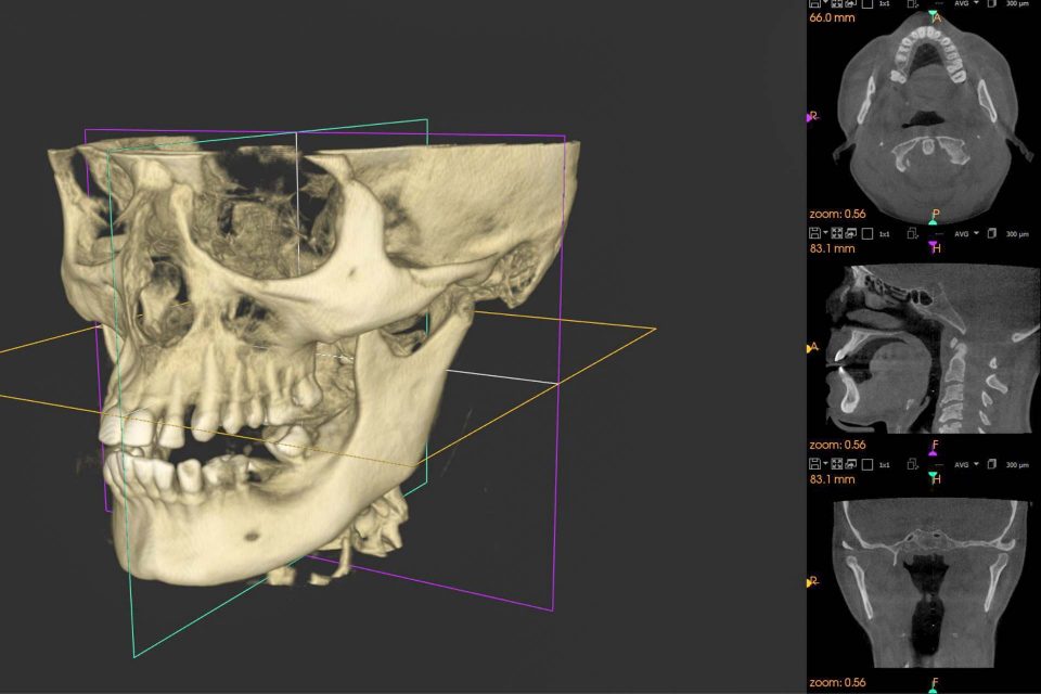 CBCT - Medicinaklinika Hévíz Fogászat - Dr. Riedling Zsolt fogszakorvos